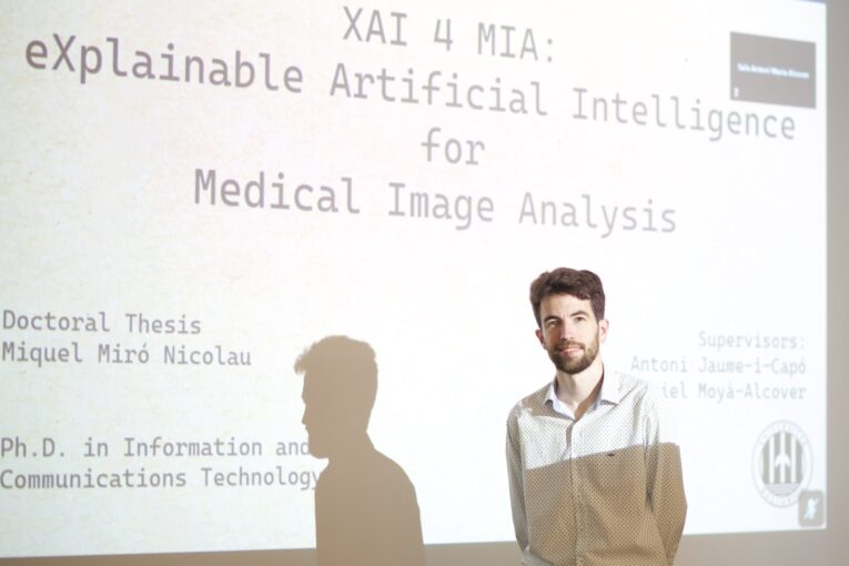 El campaner Miquel Miró, es doctora amb una tesi sobre l'aplicació de la intel·ligència artificial a la Medicina